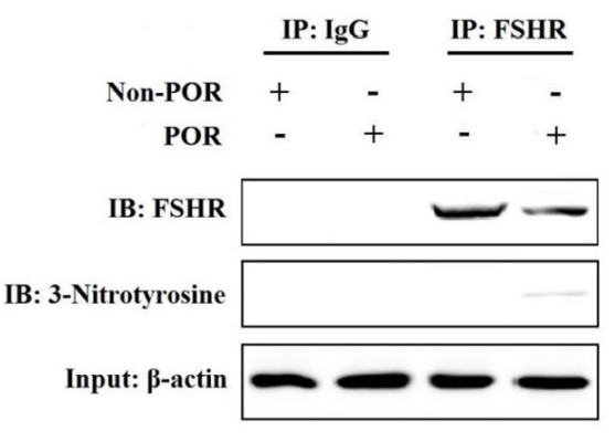 Identification of tyrosine nitrated FSHR protein in human GCs.jpg